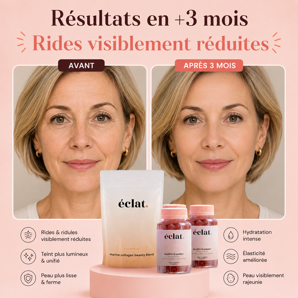 Rides visiblement réduites